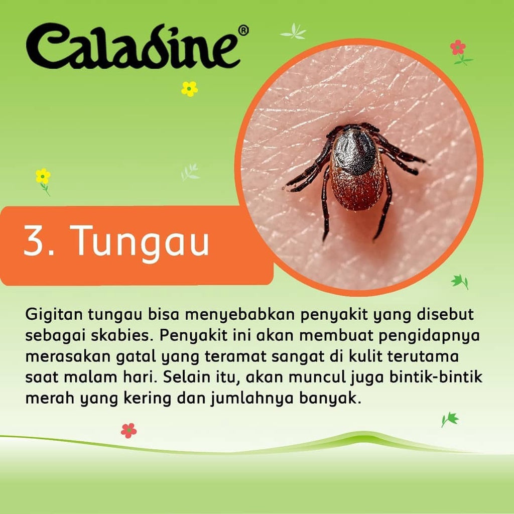 Caladine Lotion 95ml | Soothing Relief for Itchy Skin | Caladine Cair #indoshop#